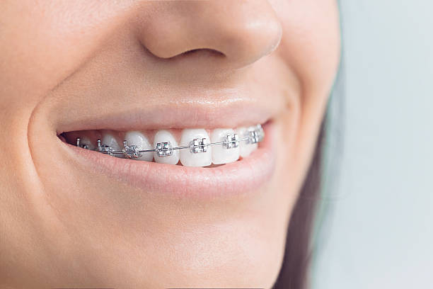 Elkhart, TX Dental Services Company